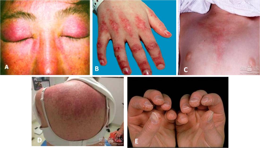 爸妈说你“二天”一定要得的这种病，到底是个啥子病？