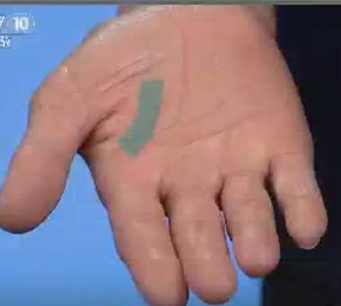 手上发红发紫是怎么回事,手部发青要警惕