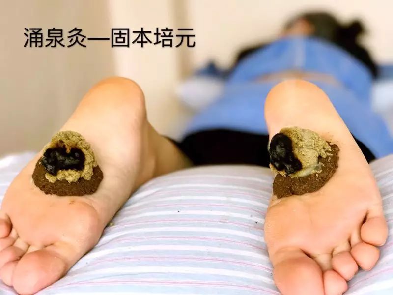 一叶知秋，雪中送炭话艾灸