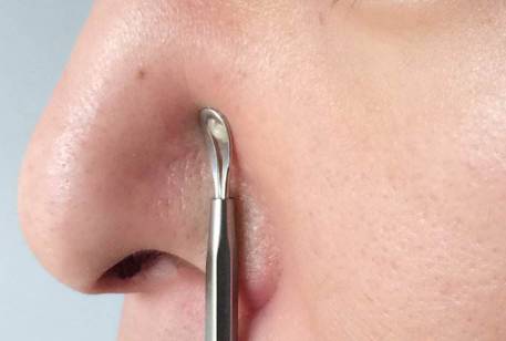 黑头反反复复去不掉,黑头老是反复怎么去解决