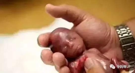 早产儿怎么护理能提高智力发育,早产儿的护理和喂养方法书籍