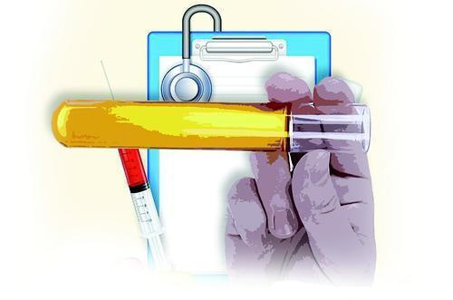 尿检指标科学解读！