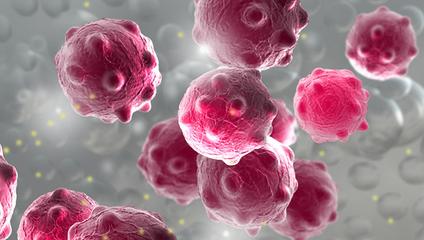 肾病患者如何降蛋白、潜血?2个方面,缺一不可!