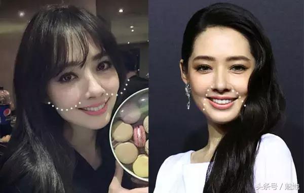 法令纹显老不用愁一招改善法令纹,法令纹的种类和改善方法有哪些