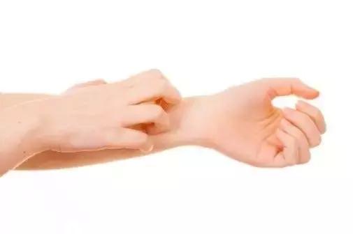 防蚊止痒哪种效果好,防蚊止痒花露水