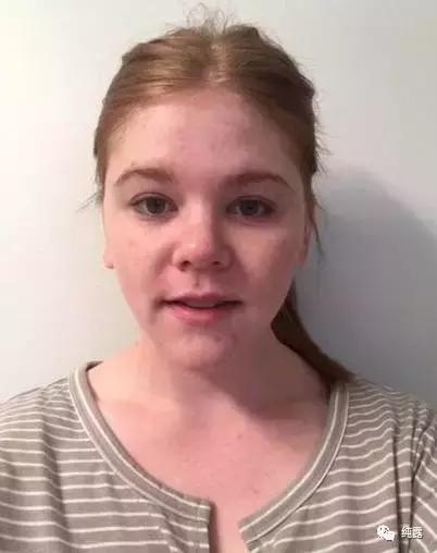 如何制定一个适合自己的纯露补水方案