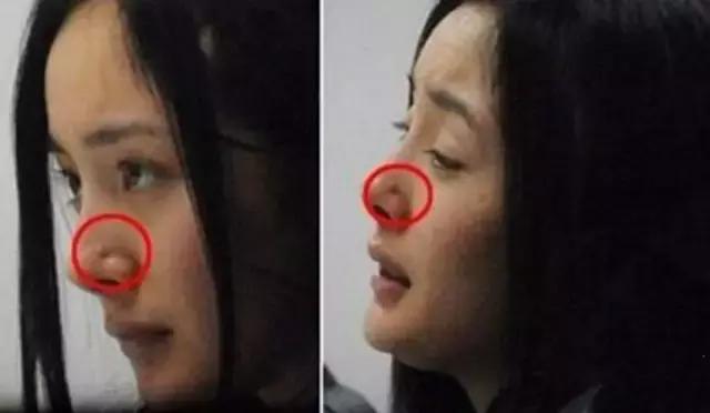 烂脸救星爆痘,烂脸救星成烂脸神器