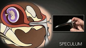 4个月引产无痛好还是普通引产好,五个月引产做无痛引产真的不痛吗