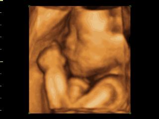 医院的b超检查设备都一样吗,医院的b超是什么