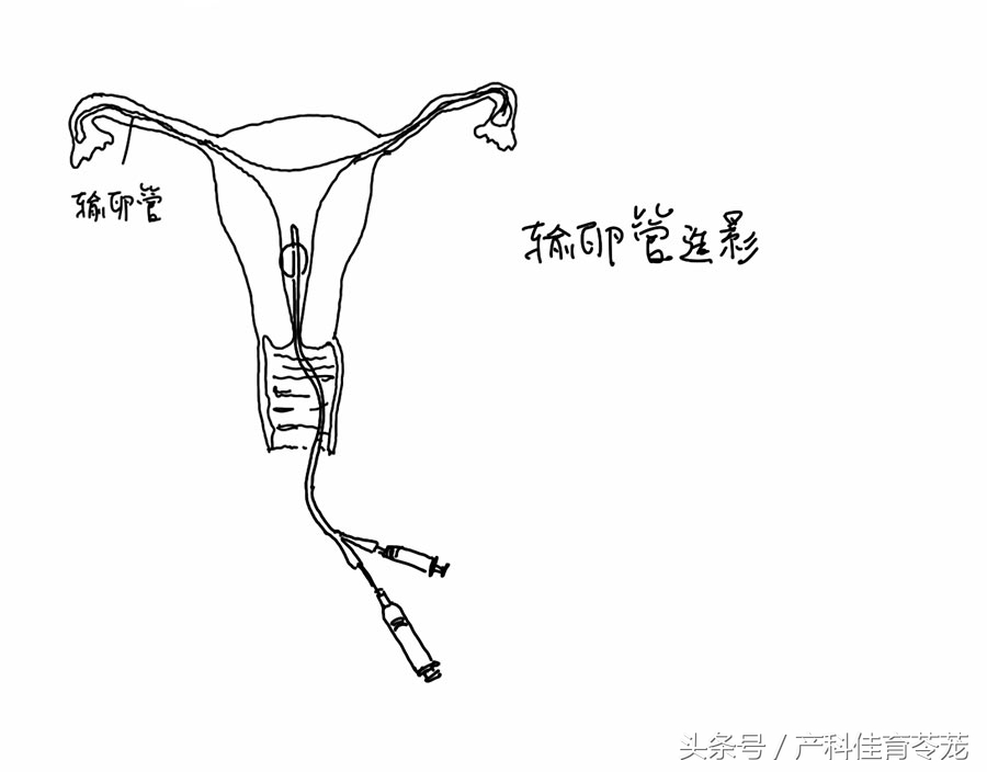 临汾孩子,怀不上宝宝了怎么办啊