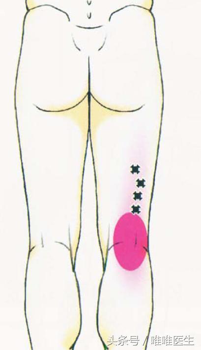 膝关节科普文章,膝关节疼痛最全解析