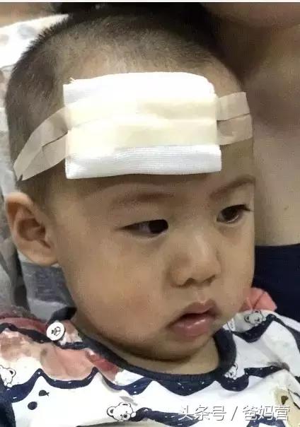 2岁宝宝摔跤手指破皮出血,小孩子摔跤出血去医院缝针