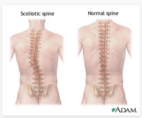 康睿仕脊柱矫正靠谱吗,康睿仕体态矫正