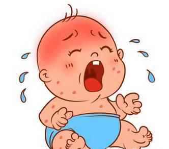 大宝二宝都有湿疹 (小宝得了湿疹大宝要注意什么)