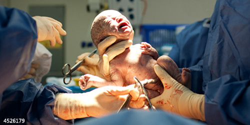 分娩时，“开五指”“开七指”到底是什么意思？