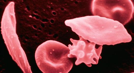 手臂上长了小红点不痛不痒像痣,出现小红痣不痛不痒