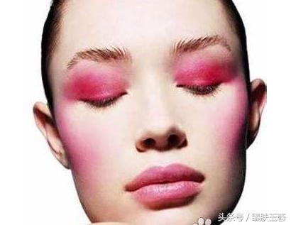 换季起皮红血丝,敏感皮肤有红血丝先去哪里