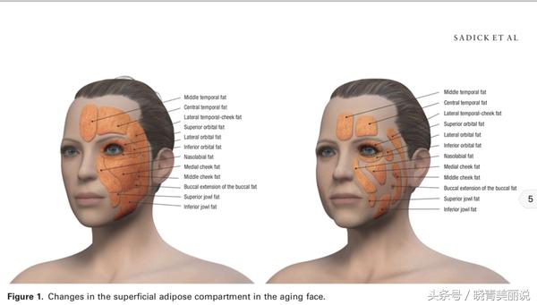 孩子刚出生就有法令纹,15岁小孩为啥有法令纹