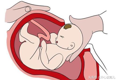 女人一生最多能剖几次产,一胎剖宫产的二胎要不要提前剖