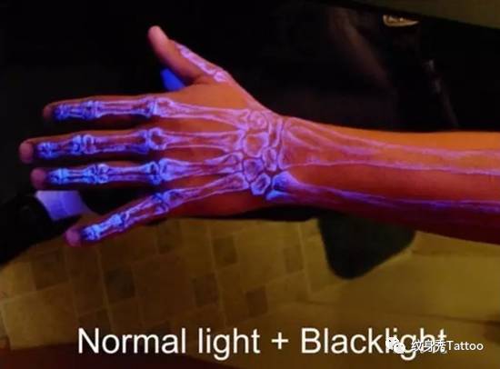 它是夜店的焦点，时尚的宠儿，医院……的心病……