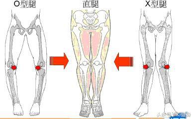 腘绳肌和半月板间隙,膝关节半月板根部解剖