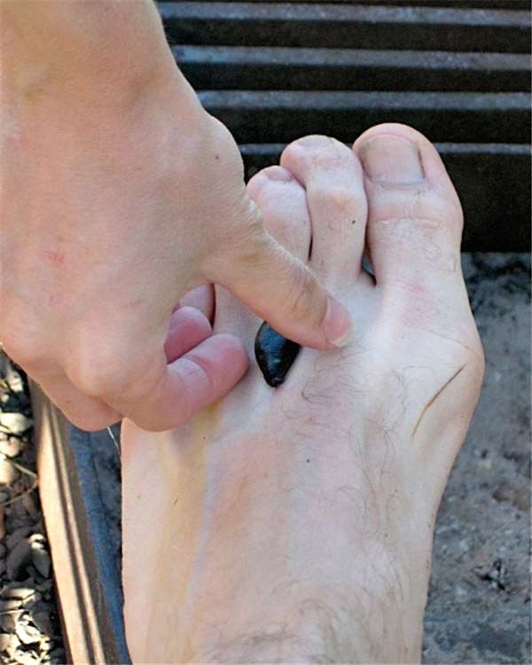 如果让水蛭吸饱血会怎么样,水蛭吸到我们身上会有什么反应