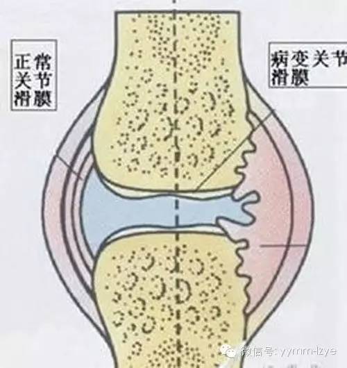 孩子腿疼不能弯曲怎么回事,孩子腿疼不一定是长个子