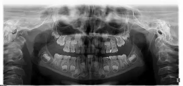 酒店枕头中间有个洞是做什么用的,酒店客房枕头都有哪些
