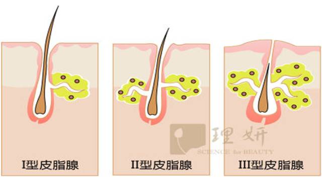 痘疮病怎么治疗,痘疮的中医辨证治疗