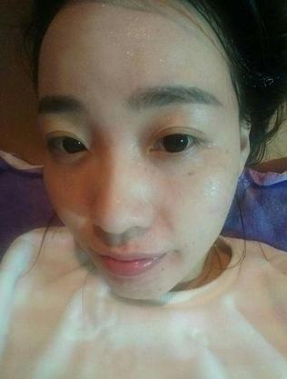 妈妈为女儿消脸上疤,妈妈为了孩子不容易