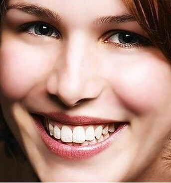 牙齿整形需要时间,牙齿美容整形四大方法