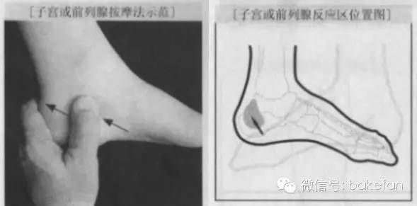 足部子宫反射区出问题怎么治疗,妇科脚底穴位反射区在哪图片