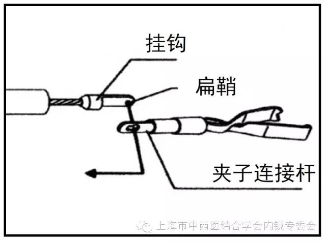 消化内镜仪器操作,消化内镜护理操作名称