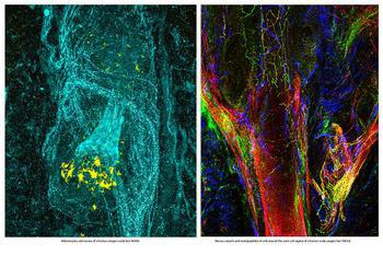 治疗脱发一定要查病因吗,治疗脱发先控油