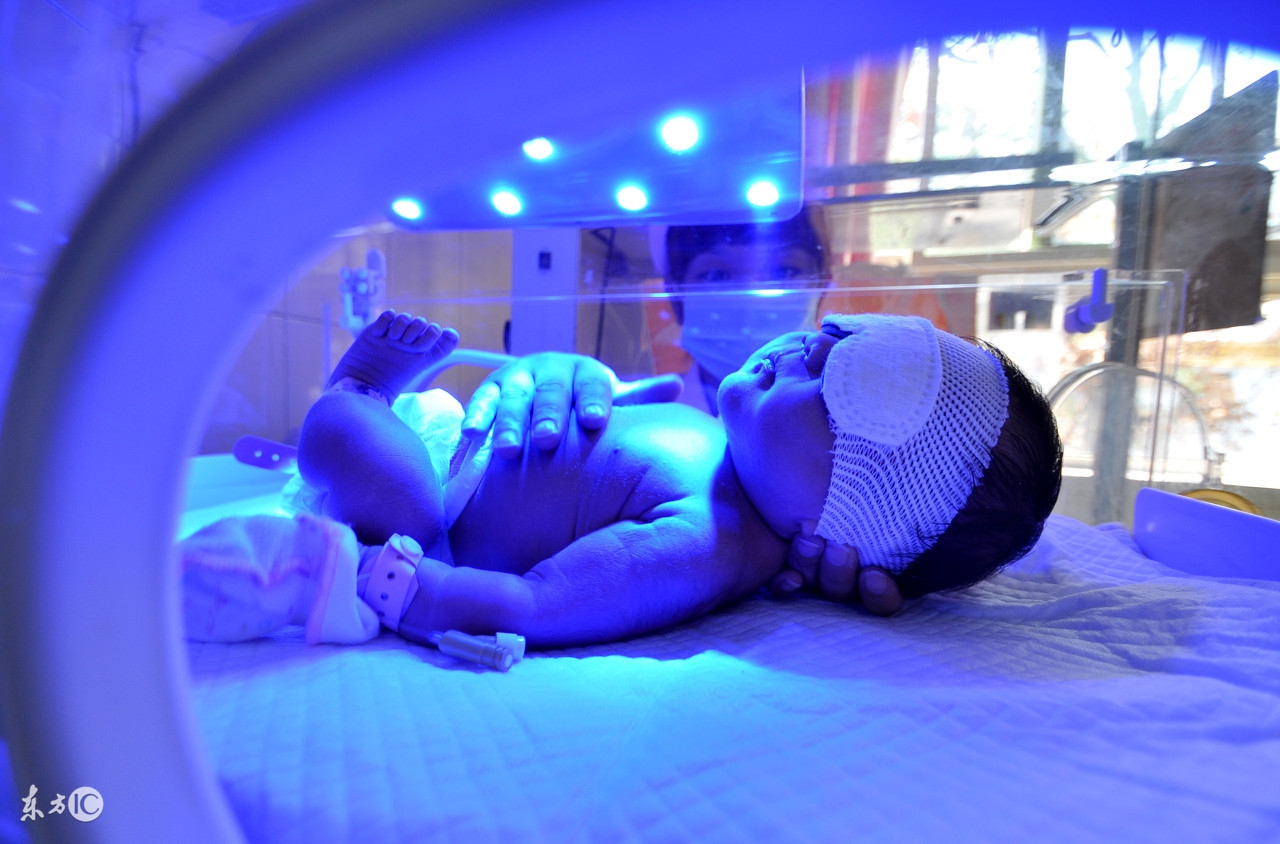 宝宝出生有黄疸是孕妇乱吃东西吗,宝宝出生7天有黄疸妈妈吃什么