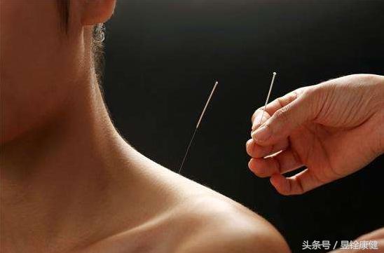 治疗颈椎病专业书籍,颈椎病的治疗的书籍