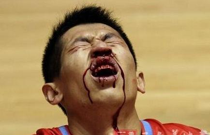 40岁女士坚持用云南白药治疗疾病，身体竟出现神奇变化！