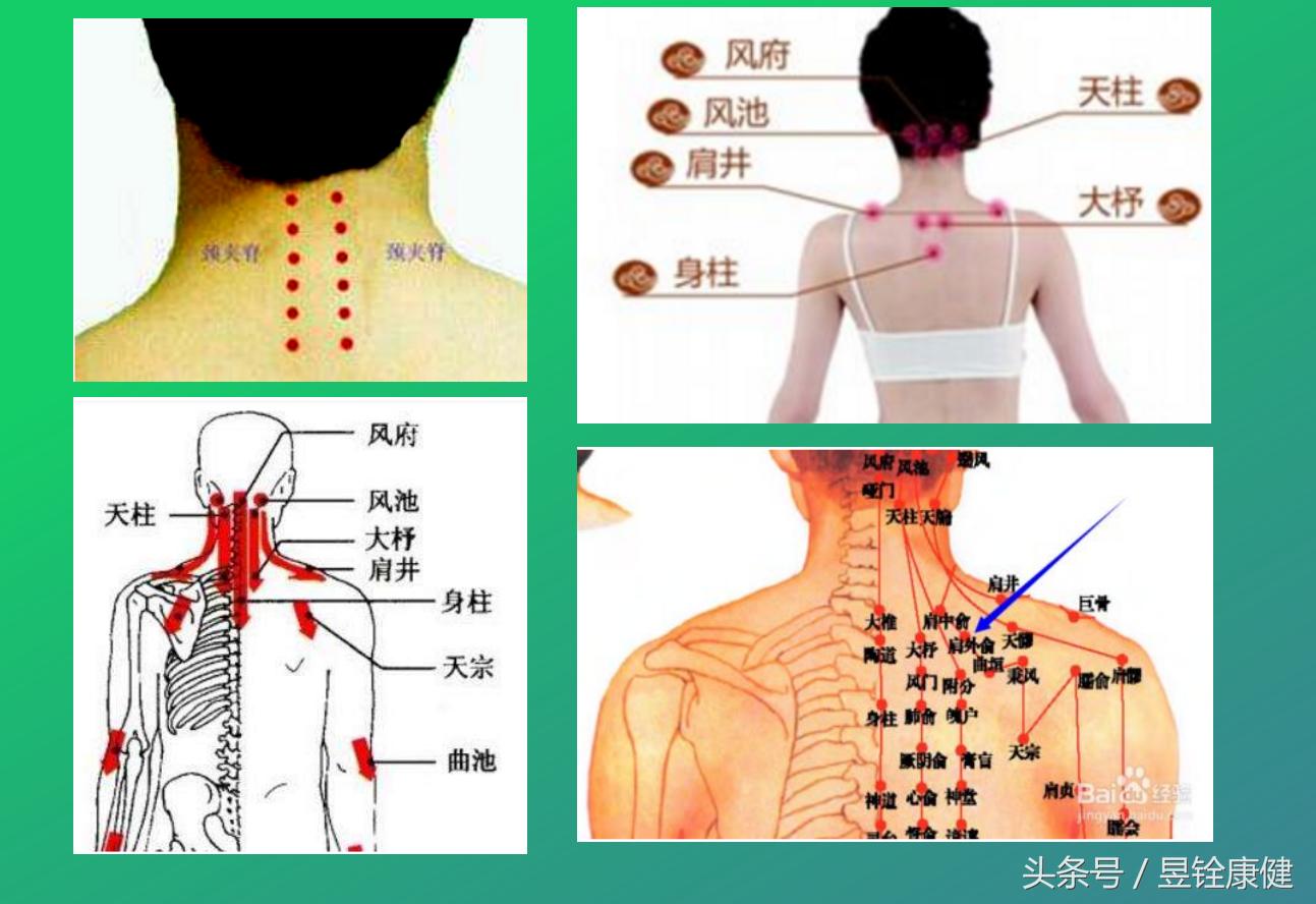 治疗颈椎病专业书籍,颈椎病的治疗的书籍