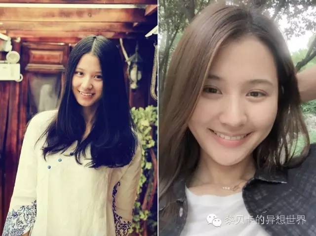 她们说||那些年整牙吞下的血和泪,终于换来最开怀的大笑