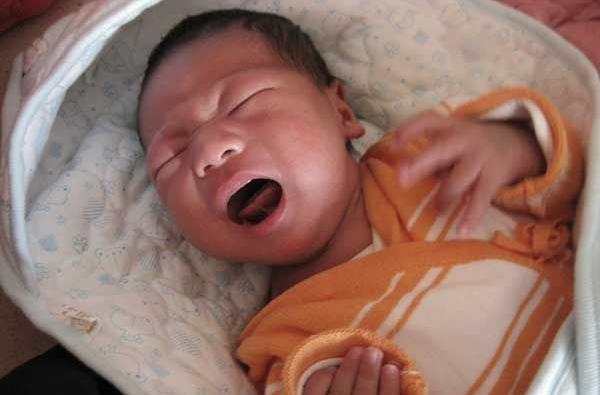 孩子的舌头是w型,宝宝的舌头是w型的应该挂什么科