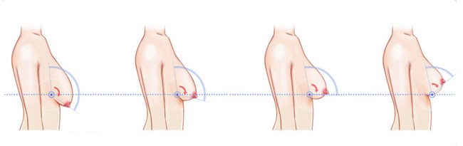 女人生没生过孩子看哪里,女人生没生过孩子去哪里鉴定