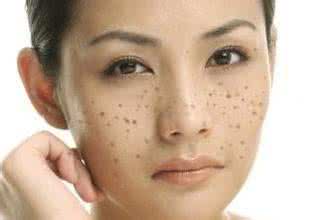脸上出褐斑怎么调理,脸上有褐斑怎么处理