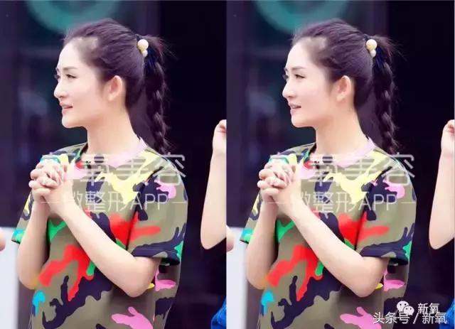 杨紫微整前后容颜对比,杨紫瘦了吗