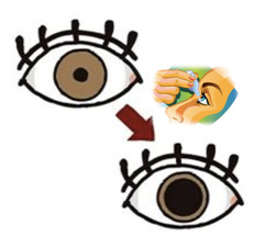 为什么配眼镜要散瞳验光,儿童散瞳验光配眼镜效果