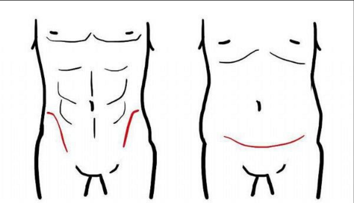 教你如何轻松练出人鱼线,怎么轻易练出人鱼线