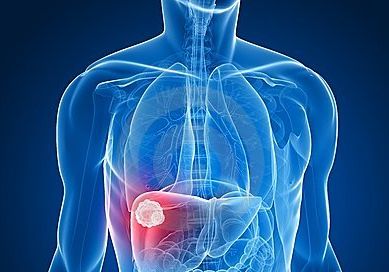 熬夜胖怎么能瘦下来,熬夜变胖怎么减肥吃什么