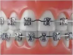 牙缝大漏财有什么说法,牙齿牙缝太宽会漏财吗