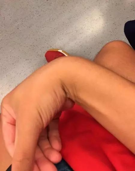 网球肘的最佳打法,三招搞定网球肘