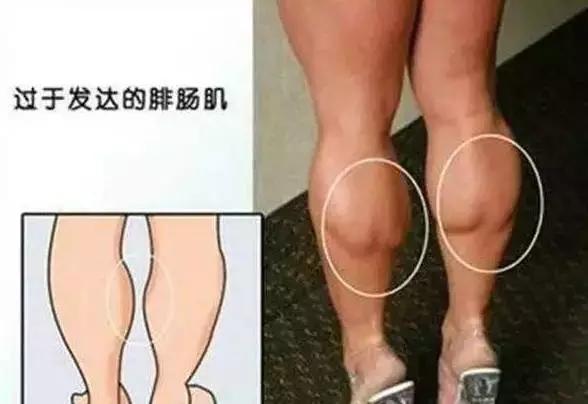 跷二郎腿真的会导致妇科病吗,跷二郎腿对脊柱危害图片