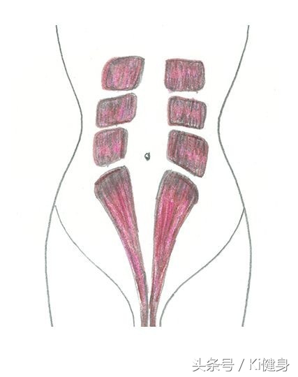 腹直肌及腹直肌分离,腹直肌脐部分离